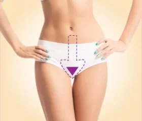 Virilha c/ Faixa Laser