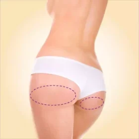 Meia Nádega – Cera