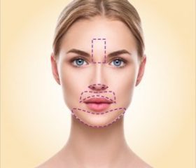 Rosto Inteiro Laser (BU+QU+NZ+PSD P)