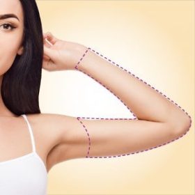 Braços Inteiros Laser