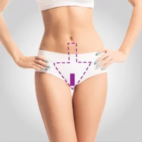 Virilha Cavada c/ Faixa Laser